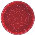 Blood Plate
