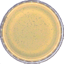 Phage/Plaque Assay