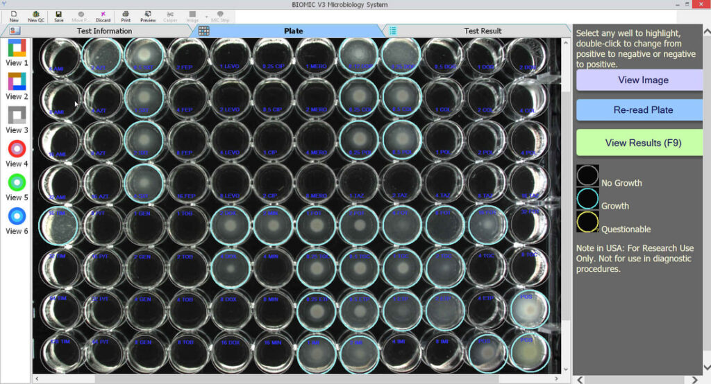 Sensititre GNX3F* - Darkfield Lighting